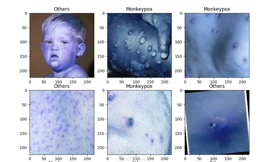 تحديد مرض monkeypox بواسطة التعلم الالي