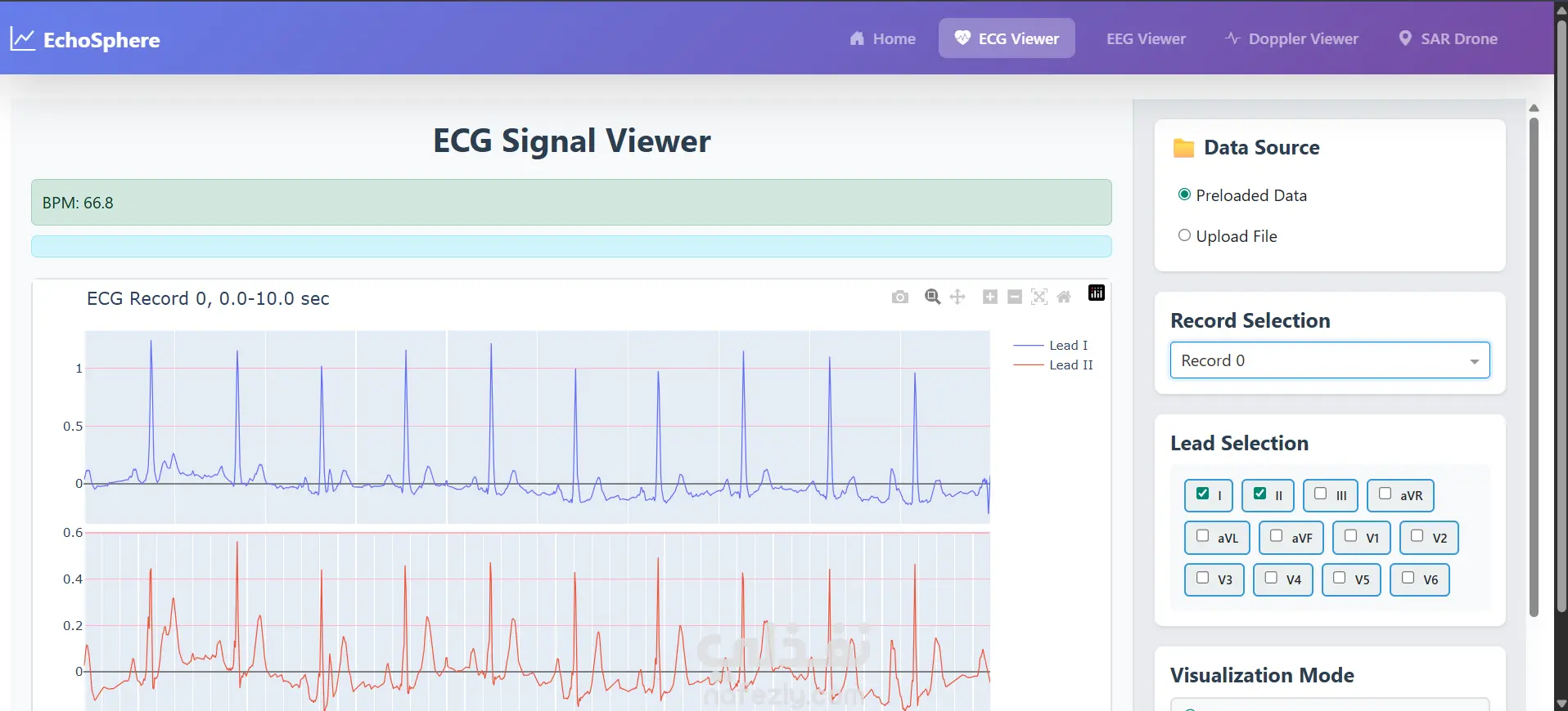 Advanced Signal Viewer