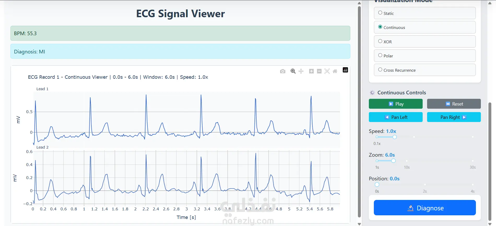 Advanced Signal Viewer