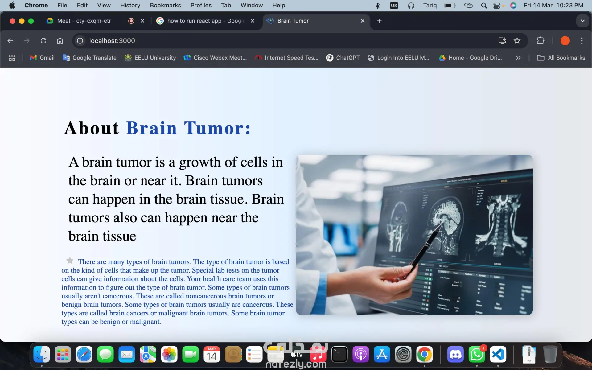 تصميم وبرمجة نظام ويب لتشخيص أورام الدماغ عبر رفع صور MRI Scan