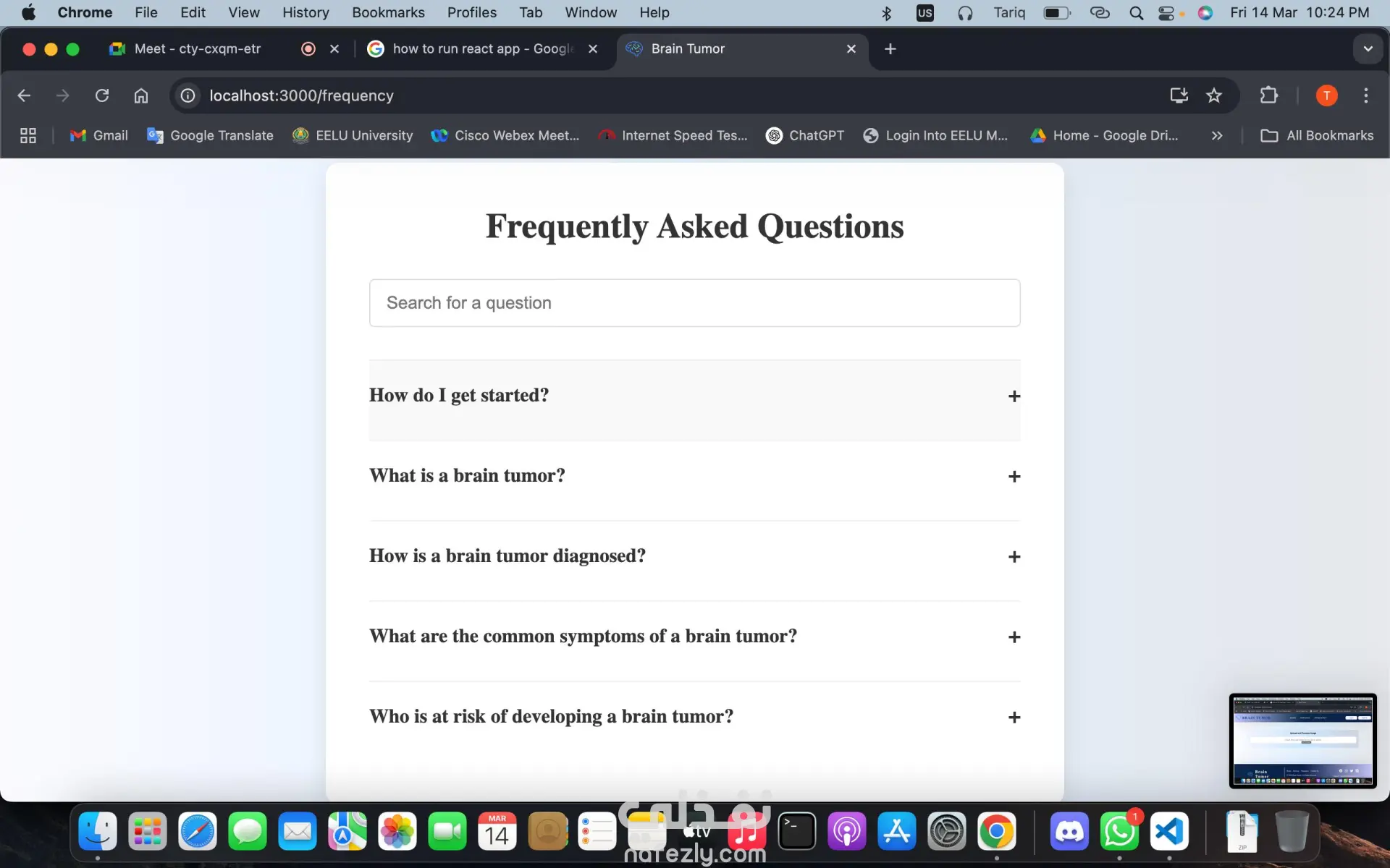 تصميم وبرمجة نظام ويب لتشخيص أورام الدماغ عبر رفع صور MRI Scan