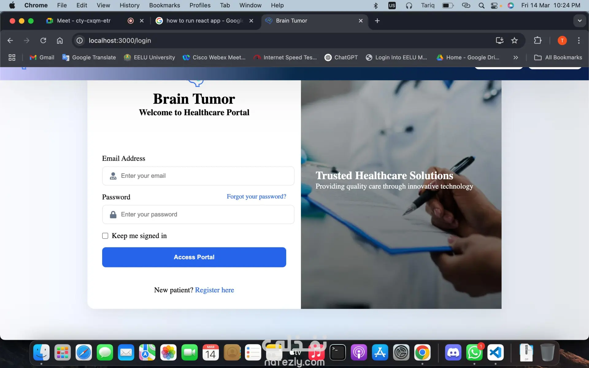 تصميم وبرمجة نظام ويب لتشخيص أورام الدماغ عبر رفع صور MRI Scan