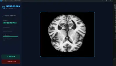 Alzheimer's MRI classification