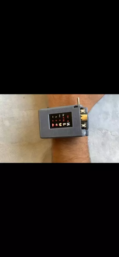 Healthcare Smart Watch Monitoring System
