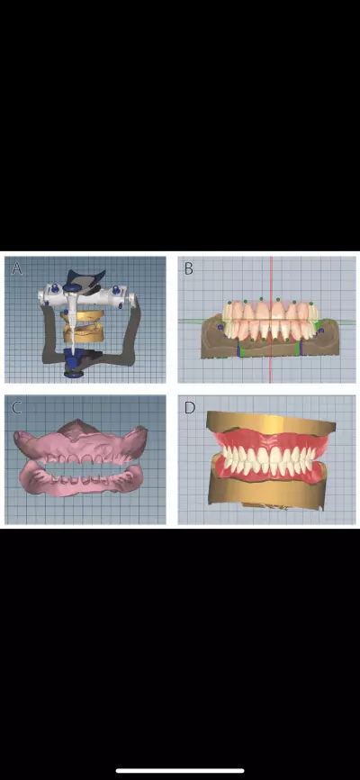 Dental Prosthodontics