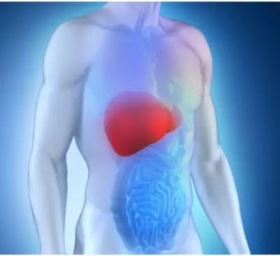 وباء فيروس سي(HCV) : رحلة من التحدي إلى الأمل