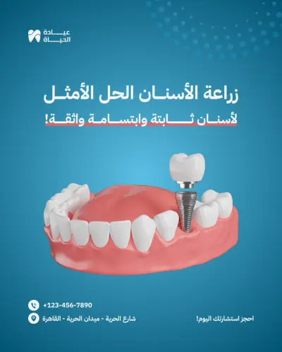 منشور إنستغرام – إعلان زراعة الأسنان