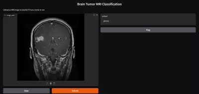 نظام كشف وتصنيف أورام الدماغ من صور الرنين المغناطيسي (MRI) باستخدام تقنيات التعلم الآلي المتقدمة