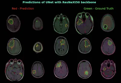 طوير نموذج ذكاء اصطناعي لتجزئة صور الدماغ بالرنين المغناطيسي (Brain MRI Segmentation Project)