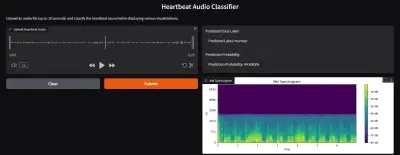 AI model that classify heart disease