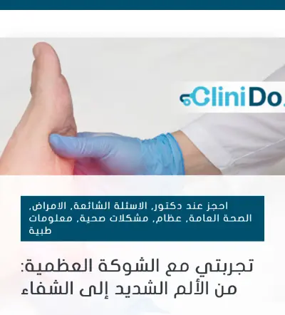 تجربتي مع الشوكة العظمية: من الألم الشديد إلى الشفاء