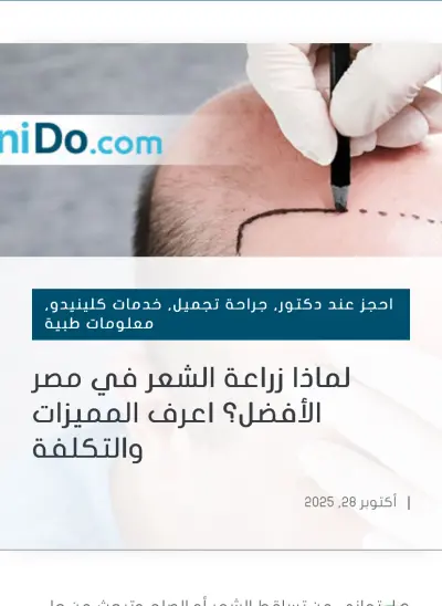 زراعة الشعر في مصر