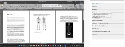 SCIENTIFIC EDITING FOR: BONE SCAN OVERVIEW