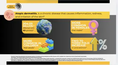 صورة العمل Atopic dermatitis ppt