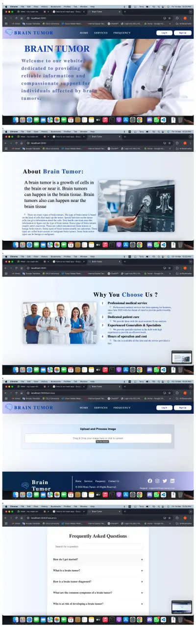 تصميم وبرمجة نظام ويب لتشخيص أورام الدماغ عبر رفع صور MRI Scan
