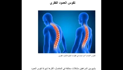 كتابة مقال احترافي متوافق مع الـ SEO