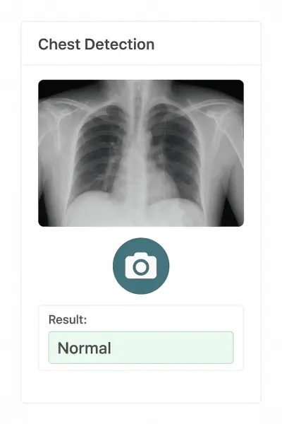 نظام كشف الالتهاب الرئوي باستخدام صور الأشعة السينية