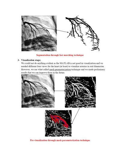 Computer-Aided Diagnosis (CAD) Program – Enhanced CATHLAB image quality using MATLAB for coronary artery diagnosis.