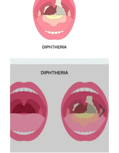 كتابة محتوى طبي متميز يناسب المواقع والمدونات الصحية