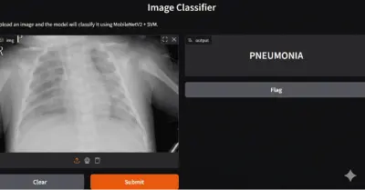 نموذج ذكي للكشف عن الالتهاب الرئوي من صور الأشعة باستخدام OpenCV وتعلم الآلة