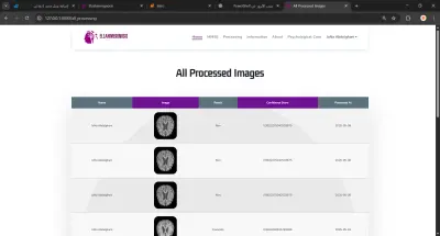 التشخيص المبكر لمرض الزهايمر