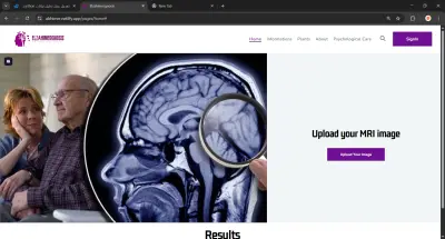 التشخيص المبكر لمرض الزهايمر