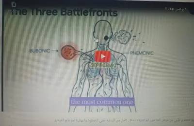 فيديو محتوي طبي عن الطاعون مونتاج وتصميم