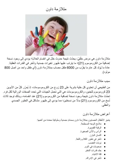 متلازمة داون