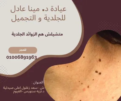 بوستر اعلان سوشيال ميديا( فيس بوك)