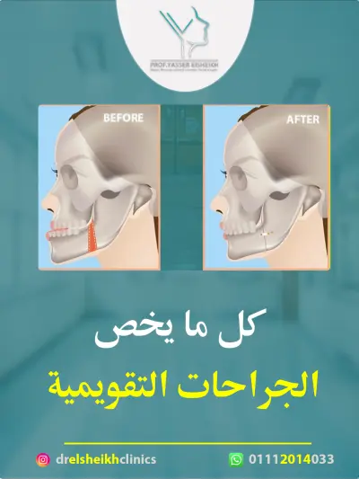 Video Editing Project