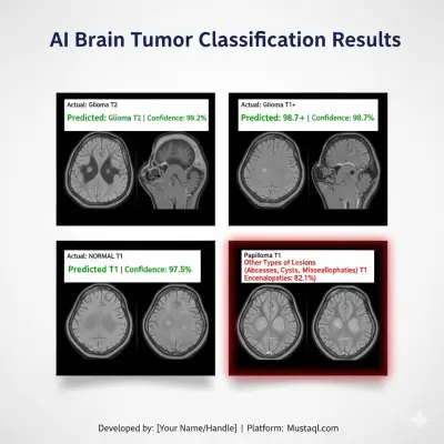 نظام ذكاء اصطناعي لتصنيف 27 نوعاً من أورام الدماغ باستخدام الأشعة الرنين المغناطيسي (MRI).