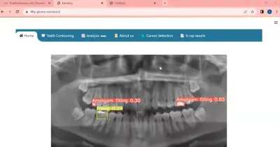 Graduation Project Deep Learning Algorithms for Dental X-rays