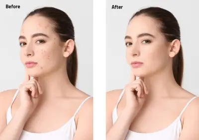 تعديل احترافي للصور مع إزالة أو تغيير الخلفية