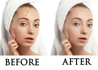 تعديل الصور