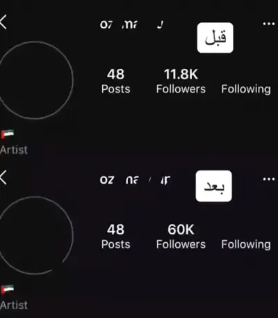 بيدج خاص بي