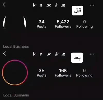 بيدج تزويد متابعين