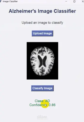 Alzheimer's Image Classifier