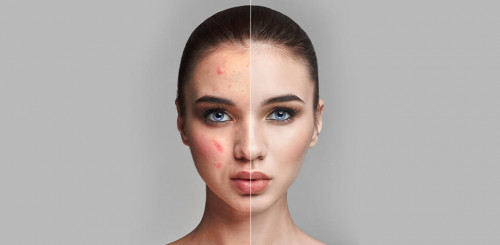 اقوم بعمل قص وتركيب وتعديل صور احترافية