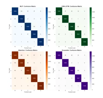 نظام معتمد على الذكاء الاصطناعي للكشف التلقائي عن أمراض اختلال ضربات القلب (ECG Arrhythmia Detection)