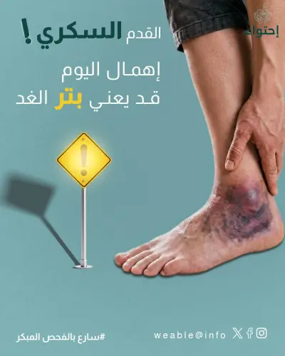 حملة دمج مجتمعي لمؤسسة WeAble