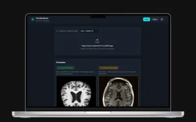 CerebroScan | تطبيق ويب بالذكاء الاصطناعي للكشف عن مراحل ألزهايمر