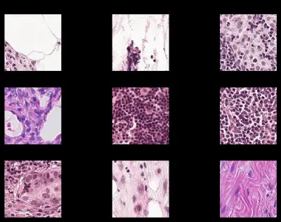 Histopathologic Cancer Detection using Deep Learning (PyTorch)