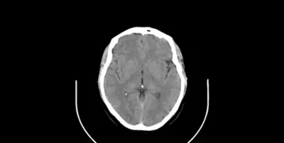 ِBrain Tumor Segmentation using U-Net