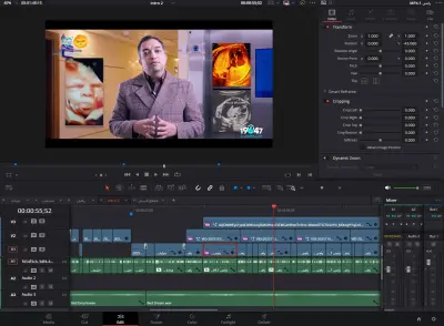 مونتاج اول عملية تتعمل في مصر ولادة بيبي بعد عمل عدة عمليات داخل رحم الأم