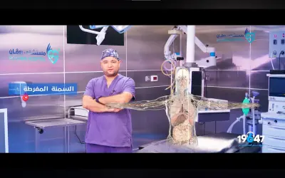 مونتاج فيديو لعملية التكميم مع إضافة مؤثرات بصرية مبتكرة بتقنية الهولوجرام،