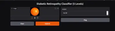 Diabetic Retinopathy Detection – Hybrid CNN & Transfer Learning