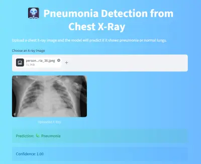 🩻 كشف الالتهاب الرئوي من صور الأشعة باستخدام الذكاء الاصطناعي