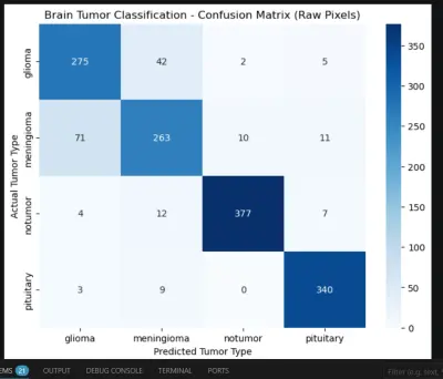 brain tumor dtection