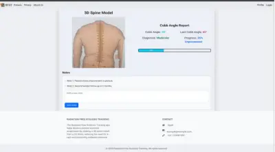 Radiation-Free Scoliosis Tracking