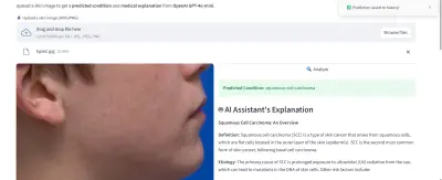 AI Skin Cancer Detection System